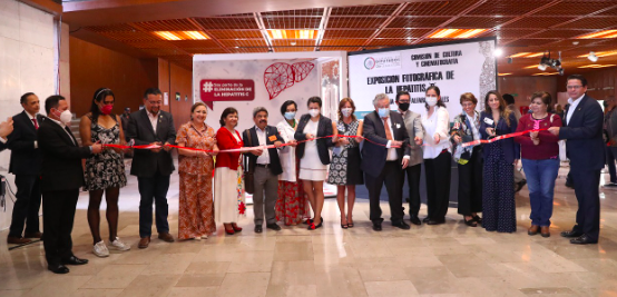 INAUGURAN EN CÁMARA DE DIPUTADOS LA EXPOSICIÓN FOTOGRÁFICA “HEPATITIS C”￼