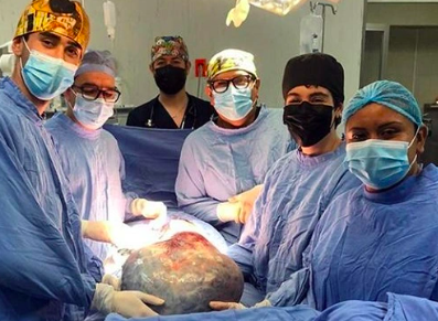 ESPECIALISTAS DEL IMSS RETIRAN TUMOR GIGANTE A MUJER DE 60 AÑOS