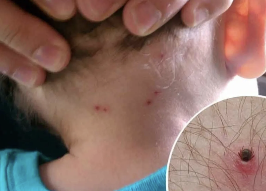 Alerta por brote de enfermedades transmitidas por pulgas: cómo proteger a tu familia y mascotas