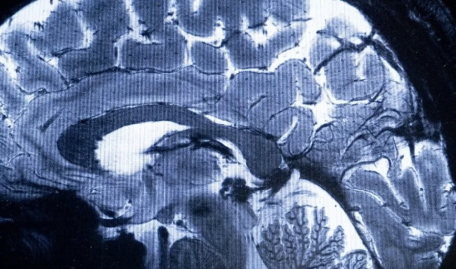 VALIDAN TÉCNICA NO INVASIVA PARA DETECTAR LA ESCLEROSIS MÚLTIPLE Y EL GLAUCOMA